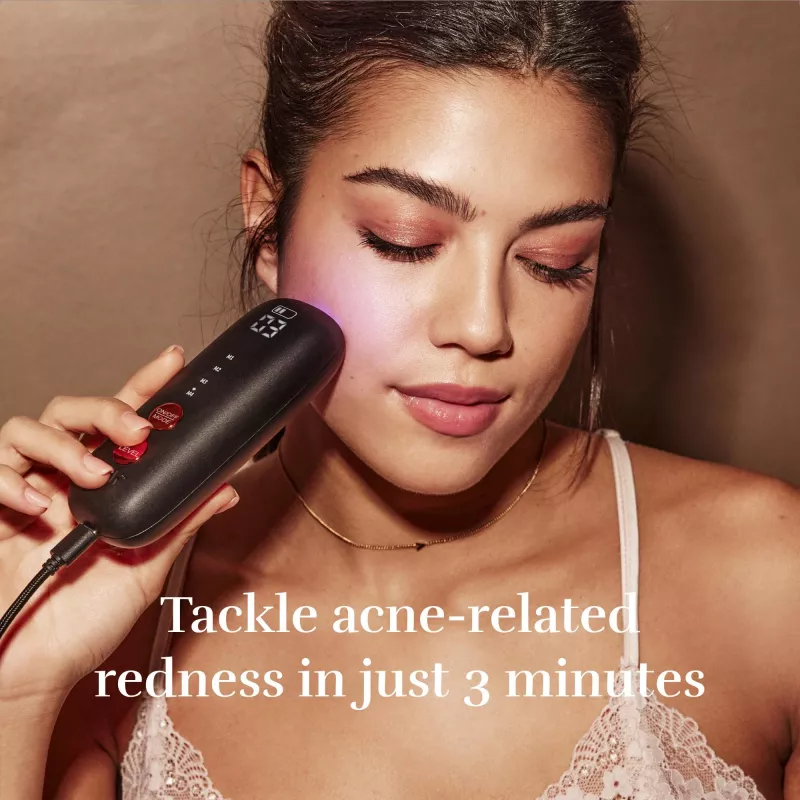 Hautlichttherapiegerät Silk'n FNLM2PEU001 — schwarz, batteriebetrieben, Anti-Aging/Anti-Falten