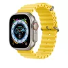 Band Apple MQED3ZM/A Smartwatch-Zubehör Gelb Fluoroelastomer