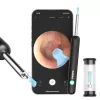 Visueller Ohrreinigungsstab Bebird R1 schwarz mit 1080P HD WLAN-Kamera