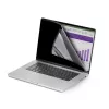 StarTech.com 16-Zoll MacBook Pro 21/23 Laptop-Privacy-Screen, entfernbarer und umkehrbarer Anti-Glare-Privacy-Filter, magnetischer Laptop-Bildschirmschutz mit 51 % Blaulichtreduzierung