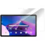 eSTUFF ES517011 Tablet-Bildschirmschutzfolie Klare Bildschirmschutzfolie Microsoft 1 Stk.