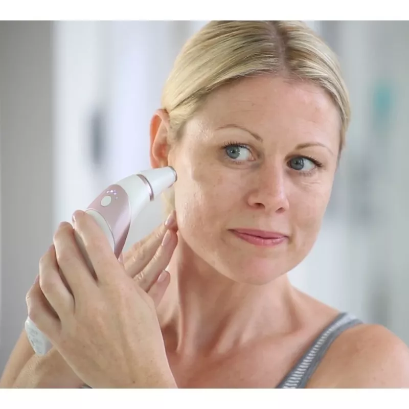 HoMedics Radiance Hautpflegegerät Hautvakuum-Mikrodermabrasion Roségold, Weiß