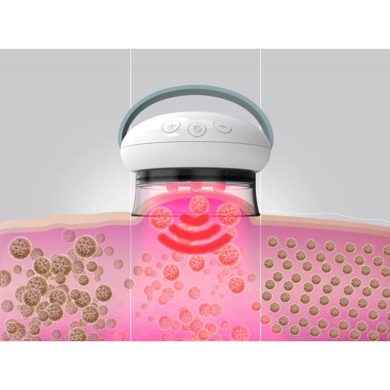 HoMedics Smoothee IR Massagegerät Beine Weiß 4 Köpfe Batteriebetrieben