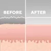 HoMedics MD-1000-EU2 Hautpflegegerät Hautvakuum-Mikrodermabrasion Weiß