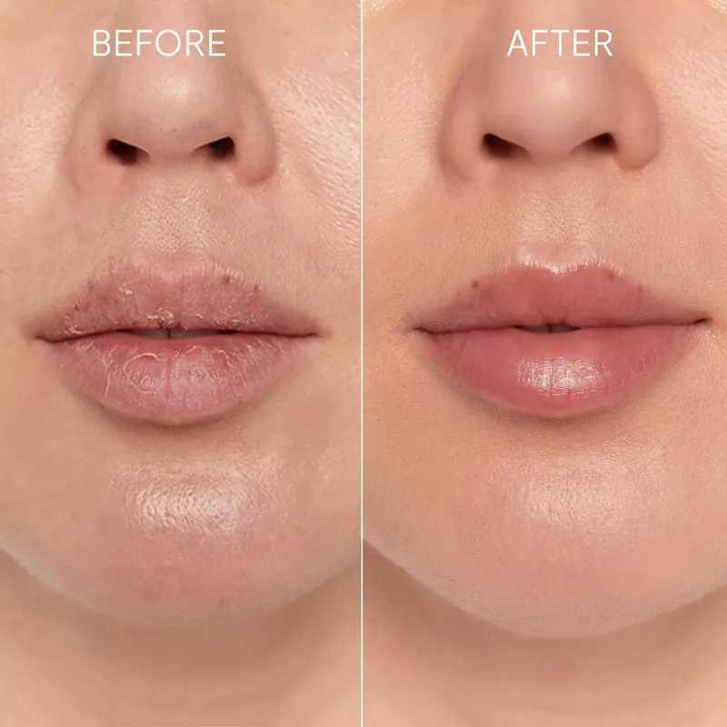 GLOV Scrubex Lip Exfoliating Mitt - 2er-Pack | Sanftes Mikrofaser-Lippenpeeling für geschmeidige Lippen