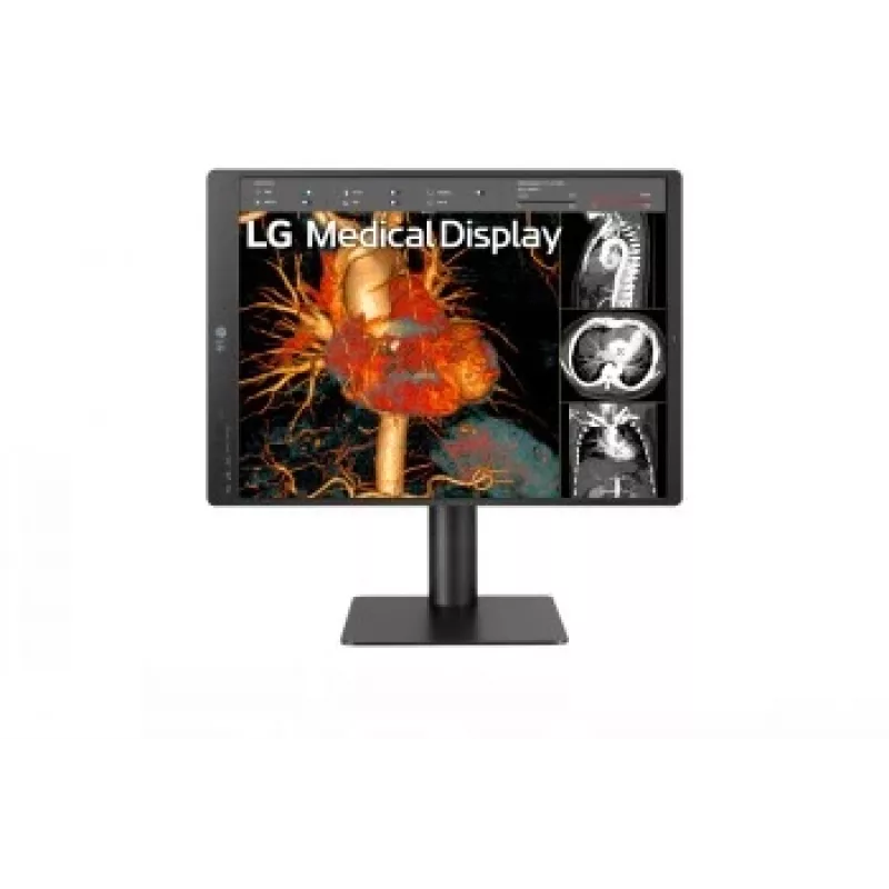 LG 21.3 inch 3MP IPS Diagnosemonitor 21HQ513D-M