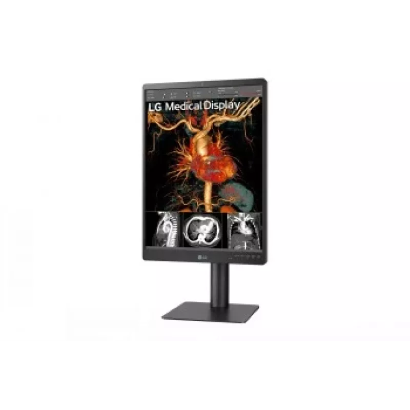 LG 21.3 inch 3MP IPS Diagnosemonitor 21HQ513D-M