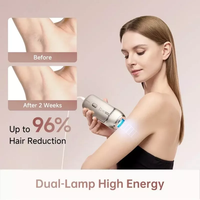 Dreame AHR01-GOLD IPL-Haarentfernungsgerät Nova Gold mit 990.000 Blitzen, 5 Energiestufen, UV-Filter, kabelgebunden